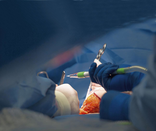 Nouveaux conseils de prise en charge locorégionale optimale après un traitement systémique primaire d'un cancer du sein