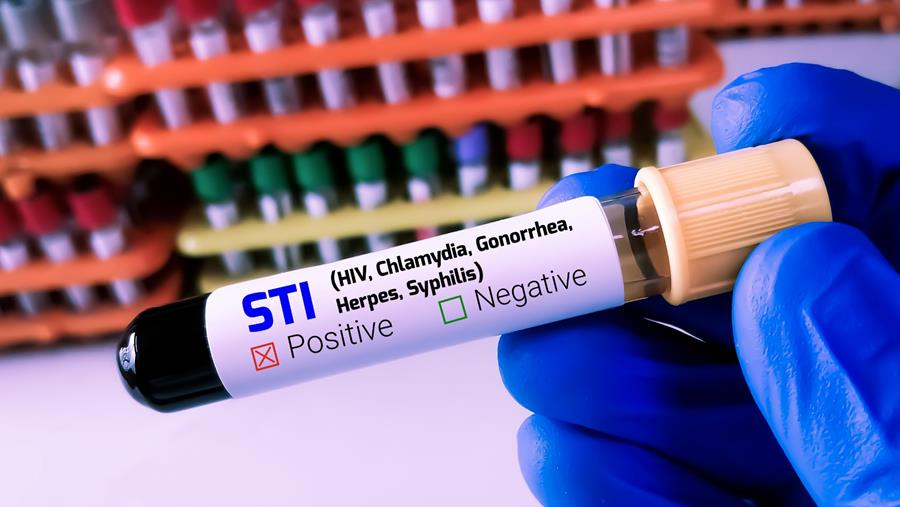DoxyPEP : efficacité maintenue en prévention des IST en pratique réelle